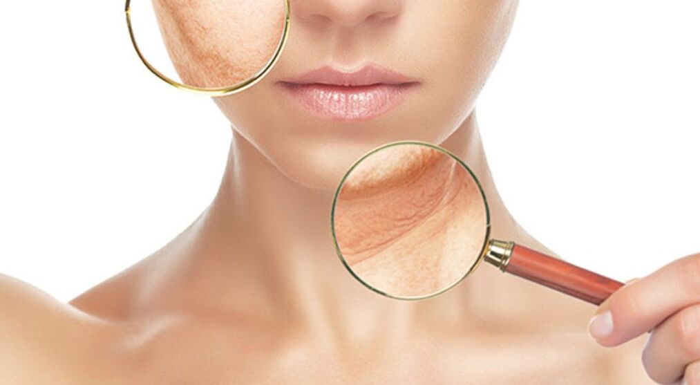 Wrinkles can be effectively removed with laser treatment