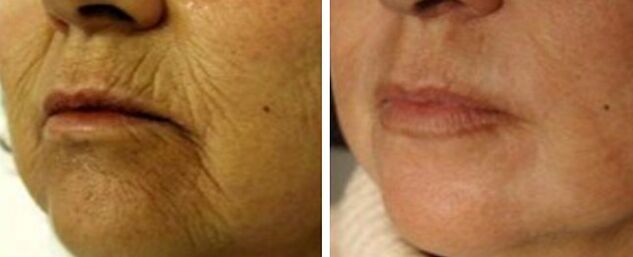 Rejuvenating 4d