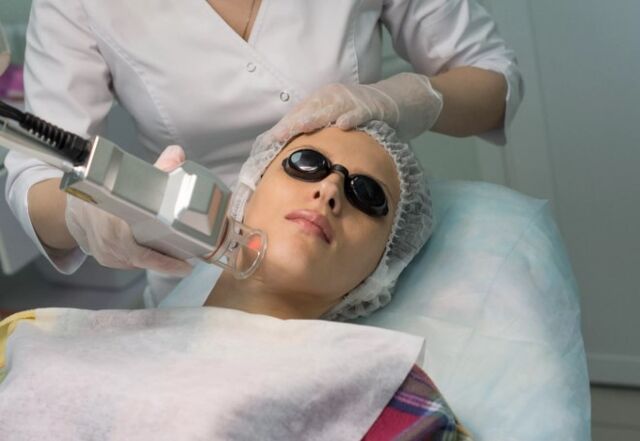 Area rejuvenation by a laser